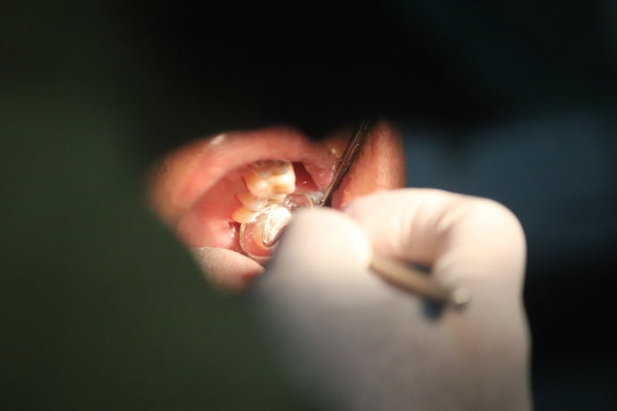 Comment la carie dentaire peut-elle être liée à votre mal de dos ?