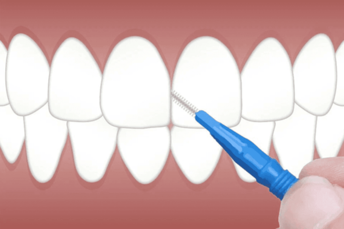 Why use an interdental brush ?