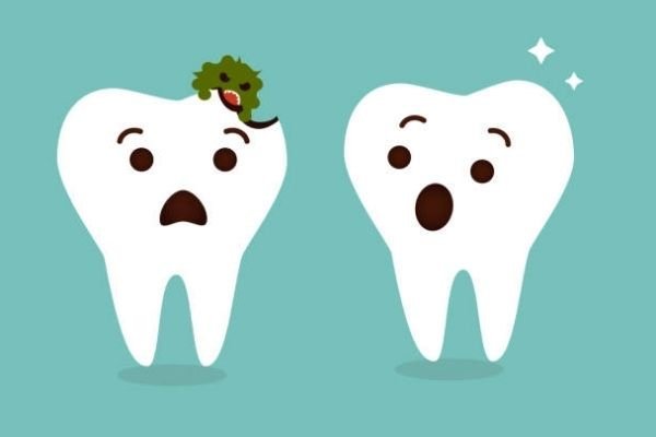Carie enfant : Causes, Symptômes et Traitement - Y-Brush