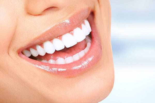 Quelle est la durée d'un blanchiment dentaire ? - Y-Brush