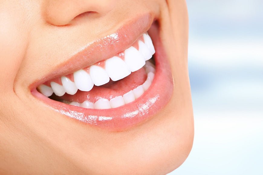How long does tooth whitening last?