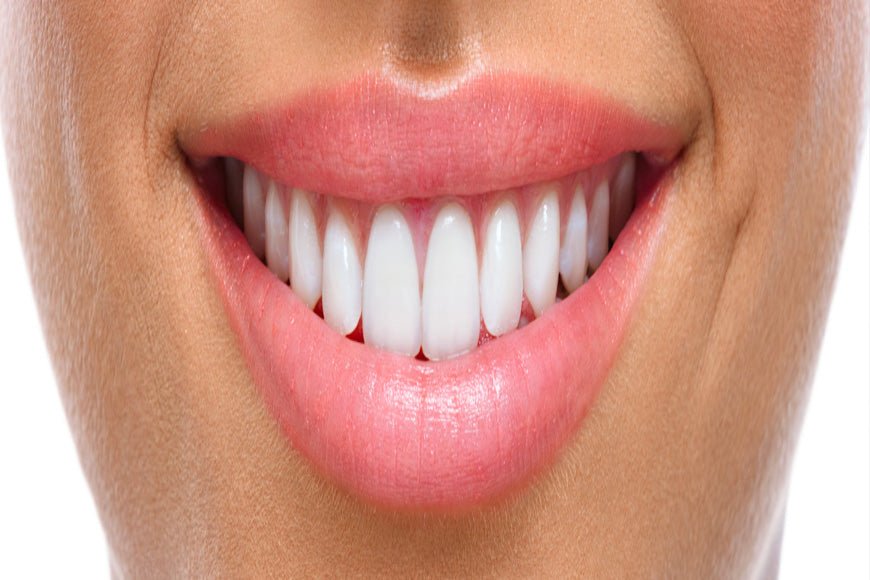 Blanchiment dentaire : ce qu'il faut savoir ? - Y-Brush