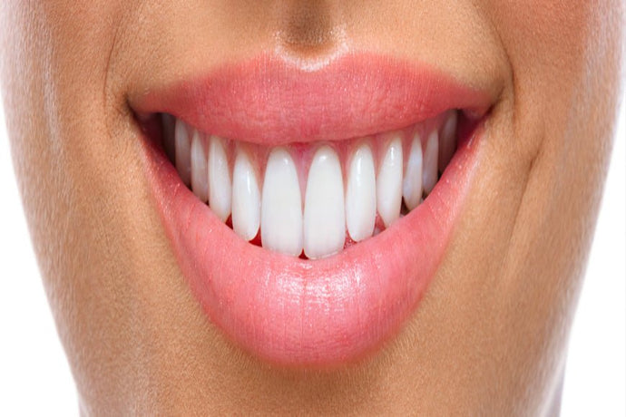 Blanchiment dentaire : ce qu'il faut savoir ?