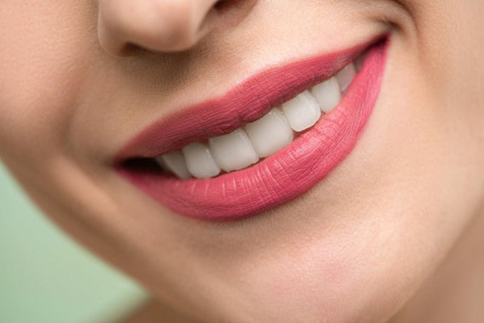 The teeth whitening kit: good or bad idea ?