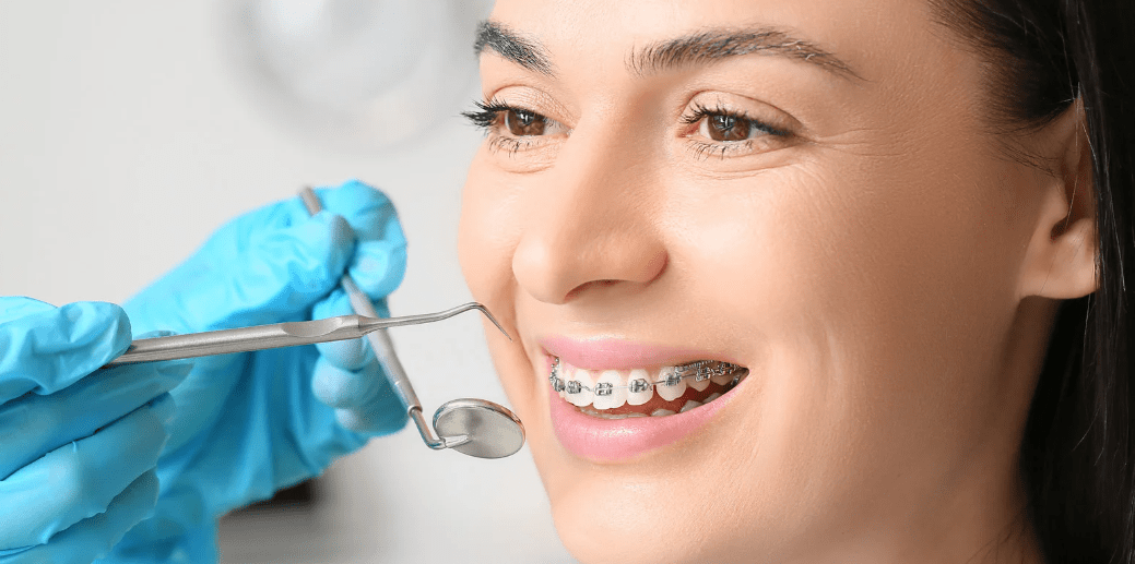 Quelle brosse à dents pour les porteurs d’appareils dentaires ? Guide complet pour un brossage efficace - Y-Brush