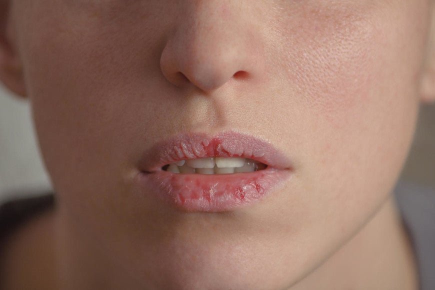 Quelles sont les causes de la bouche sèche pendant la nuit ? - Y-Brush