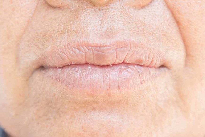 Sensation de soif et bouche pâteuse tout comprendre - Y-Brush