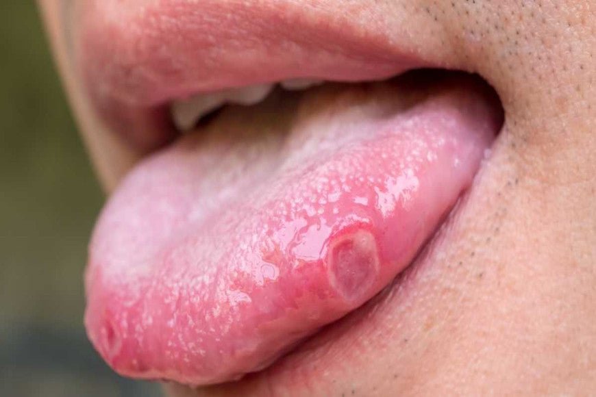 No more saliva at night: how to solve this problem
