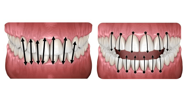 Combien de brossages de dents par jour ? - Y-Brush