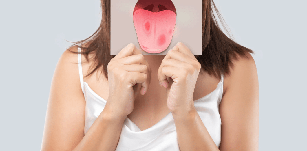 Pourquoi le brossage de la langue est-il essentiel pour une bonne hygiène bucco-dentaire ? - Y-Brush