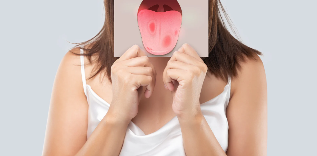 Pourquoi le brossage de la langue est-il essentiel pour une bonne hygiène bucco-dentaire ?
