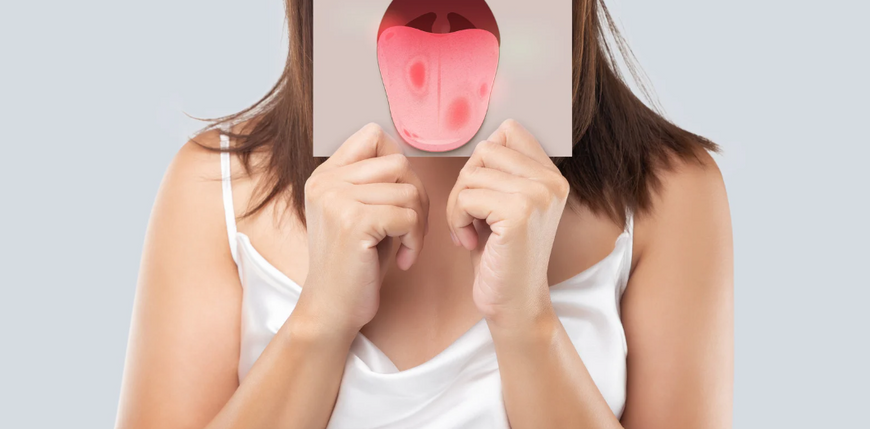 Pourquoi le brossage de la langue est-il essentiel pour une bonne hygiène bucco-dentaire ?