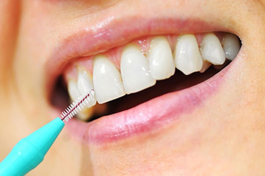 Comment choisir et utiliser les brossettes interdentaires ? - Y-Brush