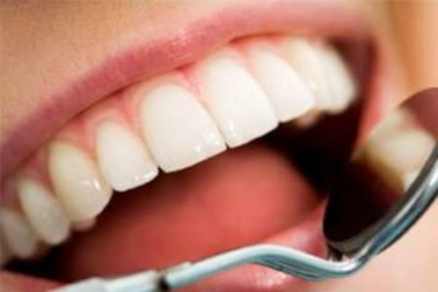 Comment traiter une carie dentaire ? - Y-Brush