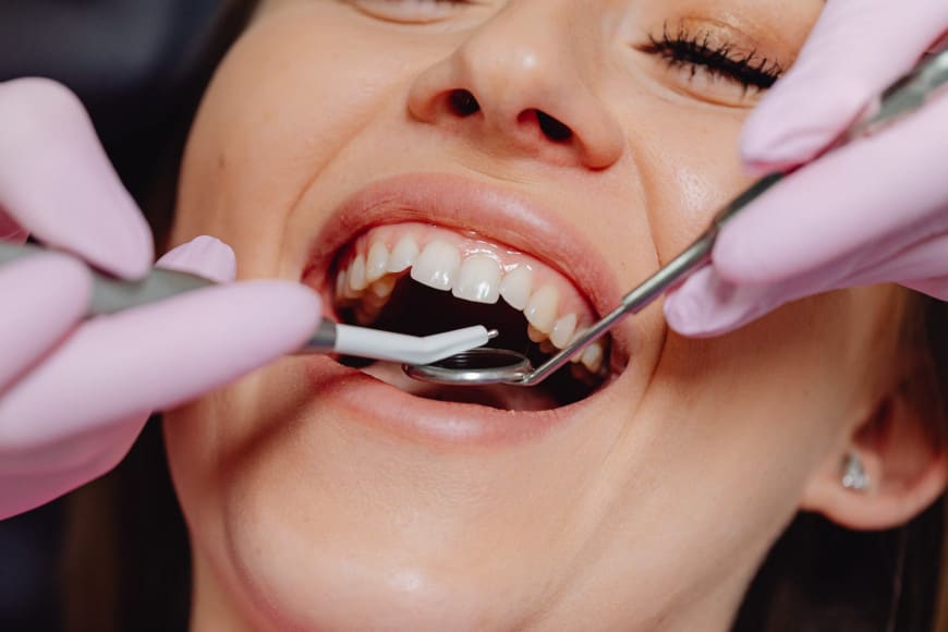 Tout savoir sur le déchaussement des dents - Y-Brush