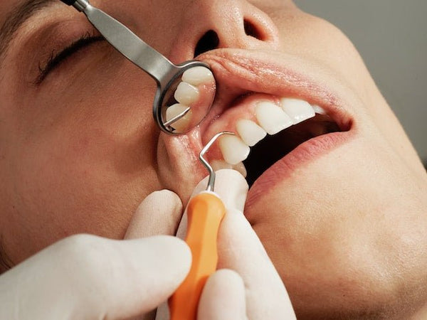 Le détartrage dentaire à la maison sans dentiste : Guide essentiel pour un sourire éclatant! - Y-Brush