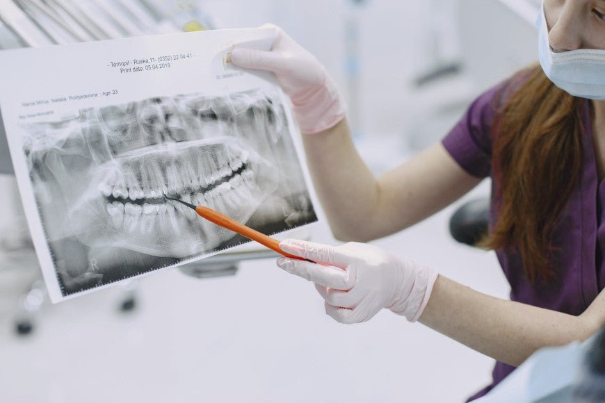 Faut-il utiliser des gouttières orthodontiques ? - Y-Brush