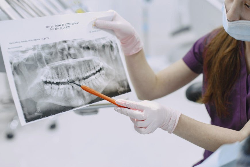 Faut-il utiliser des gouttières orthodontiques ? - Y-Brush