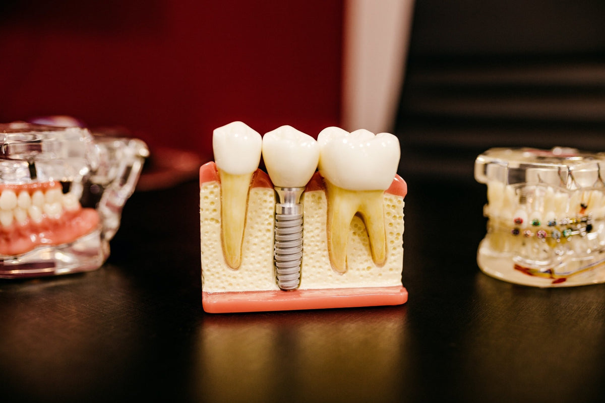 Gencive gonflée : quand faut-il consulter un dentiste ? - Y-Brush
