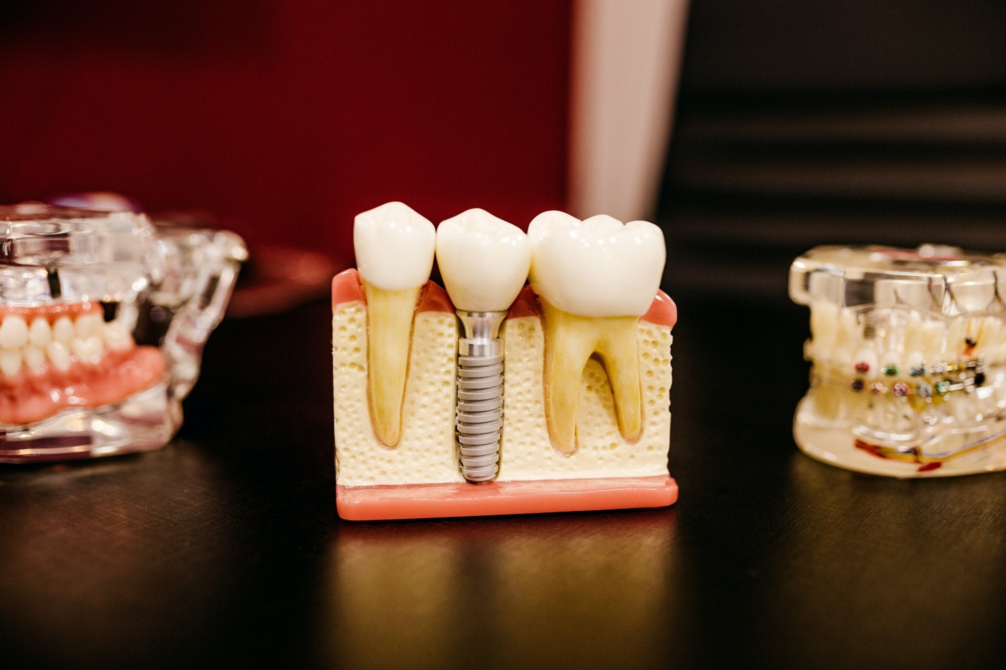 Gencive gonflée : quand faut-il consulter un dentiste ? - Y-Brush