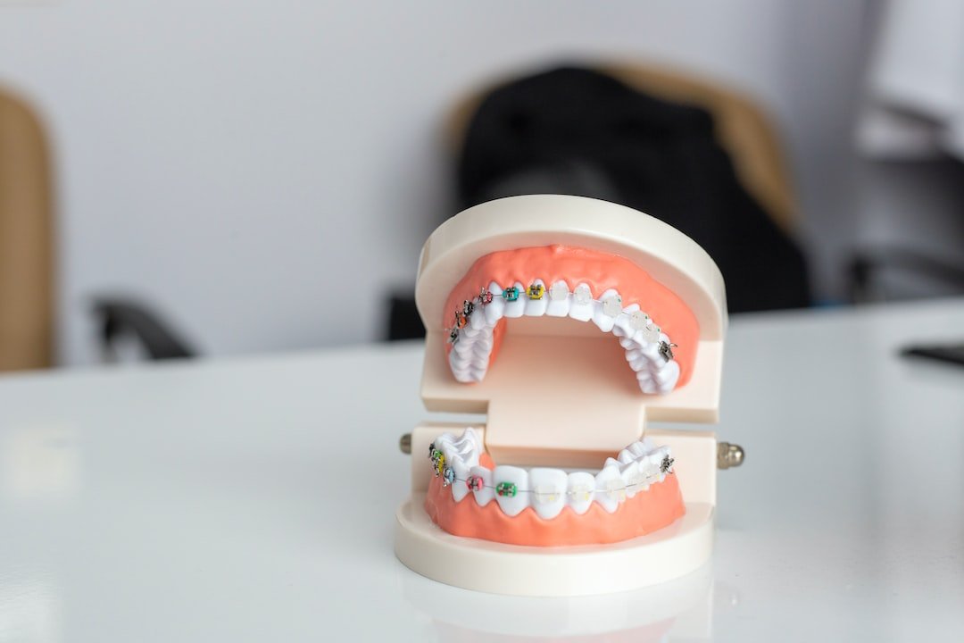 Le secret souriant: Comment détartrer vos dents avec du bicarbonate - Y-Brush