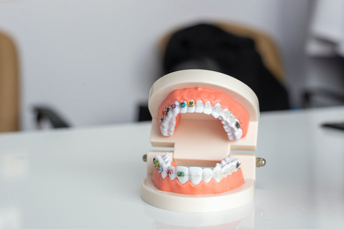 La brosse à dent électrique française : un allié pour des dents plus blanches et plus saines
