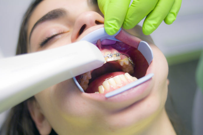 How to remove a dry tooth decay ?