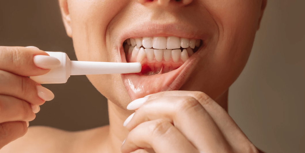 Pourquoi vos gencives saignent (et comment y remédier efficacement avec Y-Brush) ? - Y-Brush